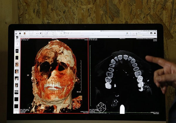 Исследования при помощи томографа в Помпеях